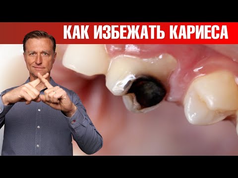 Видео: Как избежать кариеса и не допустить его появления?👀