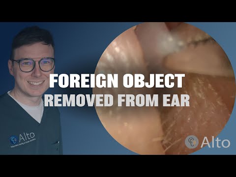 Видео: Что застряло у этого мужчины в ухе? #018