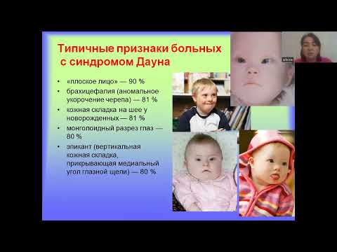 Видео: Хромасомные болезни