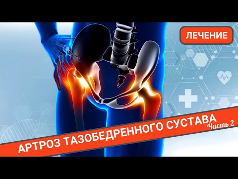 Видео: ЛЕЧЕНИЕ ТАЗОБЕДРЕННОГО СУСТАВА (Часть 2)