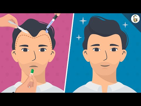 Видео: Методы лечения выпадения волос у мужчин (согласно научным данным)