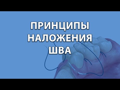 Видео: Курсы стоматологов - шовные техники - принципы наложения шва.