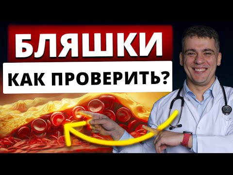 Видео: НАЙТИ БЛЯШКИ В СОСУДАХ ЗА 5 МИН! АТЕРОСКЛЕРОЗ КАК ВЫЯВИТЬ!? РОЗУВАСТАТИН, АТОРВАСТАТИН - ПОМОЖЕТ?