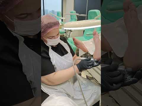 Видео: Аппарат со СПРЕЕМ 