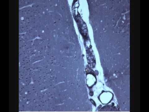 Видео: КОРА БОЛЬШИХ ПОЛУШАРИЙ ГОЛОВНОГО МОЗГА. Cerebral cortex.  Гистологическое строение