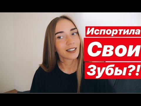 Видео: Что У Меня С Зубами?! ♡ Вся Правда О Винирах ♡ Жалею, что сделала?