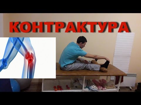 Видео: ОСТАТОЧНАЯ КОНТРАКТУРА КОЛЕННОГО СУСТАВА
