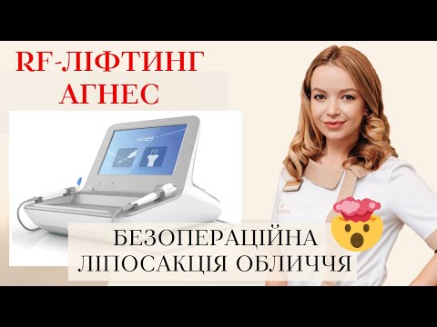 Видео: RF-ЛІФТИНГ АГНЕС 💎 РФ-ЛІФТИНГ ОБЛИЧЧЯ🤗 МІКРОІГОЛКОВИЙ РФ-ЛІФТИНГ 💉