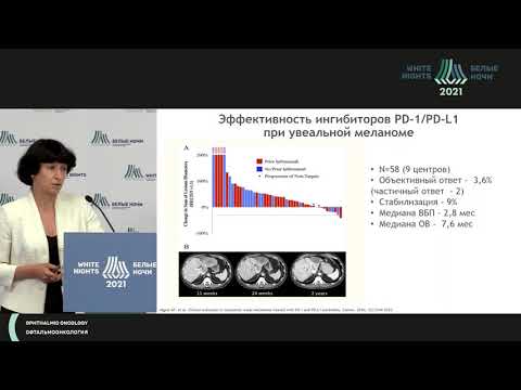 Видео: Лекарственная терапия у пациентов с распространенной формой меланомы глаза (Семенова А.И.)