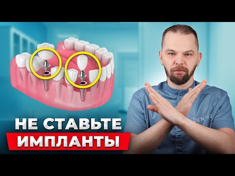 Видео: Не ставьте импланты пока не посмотрите это видео!