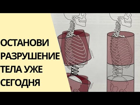 Видео: Искривление тела неизбежно! Ты можешь это остановить
