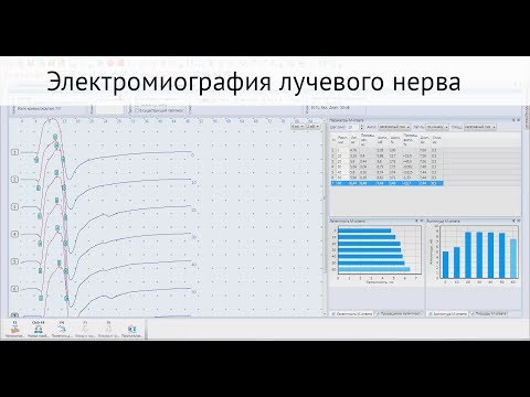 Видео: Электромиография лучевого нерва