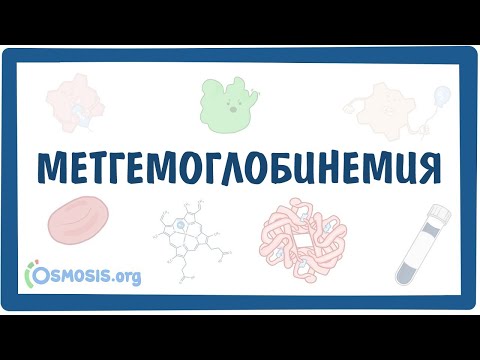 Видео: Метгемоглобинемия — причины, симптомы, патогенез, диагностика, лечение