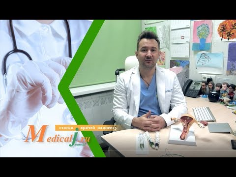 Видео: Эмболизация маточных артерий (ЭМА) для лечения миомы