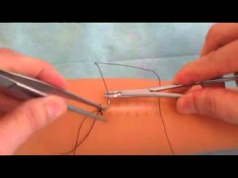 Видео: Техника наложения шва Мультановского