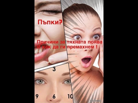 Видео: Пъпки ?! Причини,коите може би не знаете | част 1 |