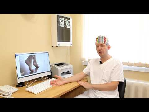 Видео: ТРАВМАТОЛОГИЯ И ОРТОПЕДИЯ | Болезни стоп и их лечение