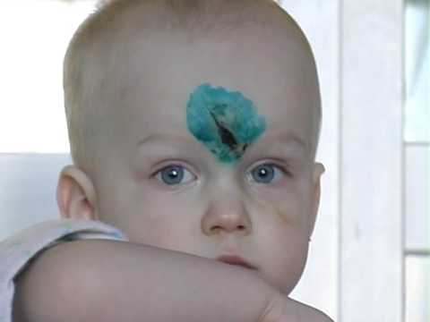 Видео: Служение сестер милосердия группы "Преображение"-ч.1-Фильм