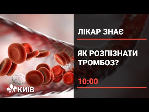 Видео: Тромбоз: чим небезпечні тромби і чому вони виникають?