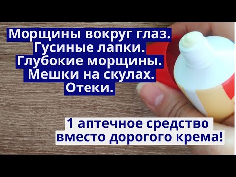 Видео: Морщины вокруг глаз. Мешки под глазами. Скуловые мешки. Отеки на лице. ВМЕСТО ДОРОГО КРЕМА!