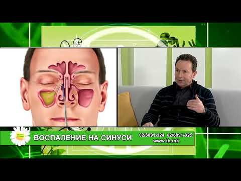 Видео: Фактор здравје - Воспаление на синуси