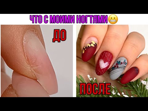 Видео: Что с моими ногтями после праздников😱Мой ужасный маникюр I Трещины в мясо🙄Градиент по сухому