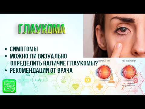 Видео: Глаукома | Можно ли вылечить глаукому навсегда?