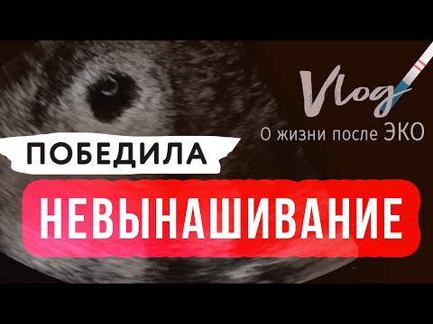 Видео: ЭКО || НЕВЫНАШИВАНИЕ || Терапия и мой опыт