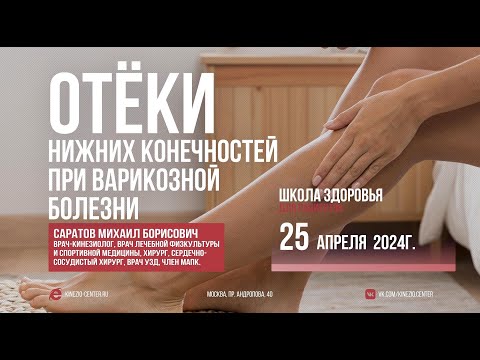 Видео: #30 Школа Кинезиологии "Коррекция отеков нижних конечностей при варикозной болезни"
