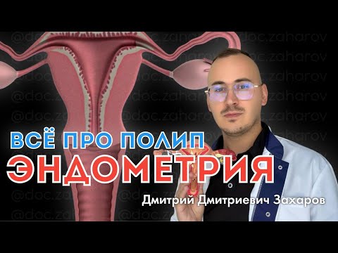 Видео: Все про полип эндометрия.