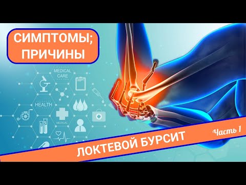 Видео: НЕ СГИБАЕТСЯ РУКА | Локтевой бурсит (Часть 1)