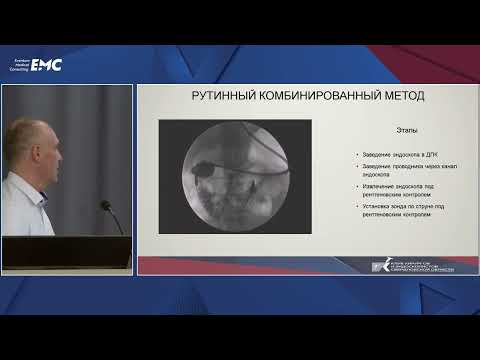 Видео: 14 Современные методики эндоскопической декомпрессии при тонкокишечной непроходимости - Нечаев А.В.