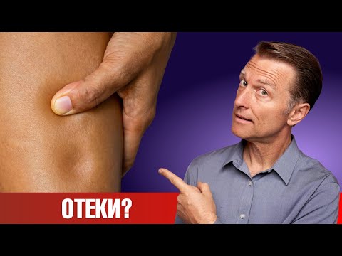 Видео: Отеки ног? 8 причин, почему у вас отекают ноги🙌