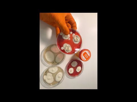 Видео: Методы экспресс-диагностики патогенных грибов (1я часть эфира)