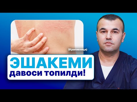 Видео: Эшакеми, Крапивница — сабаблари ва даволаш усуллари | 90 788 83 13