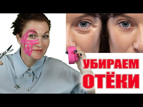 Видео: Отеки лица и вокруг глаз убираем! Без риска осложнений!  Схема тейпирования.