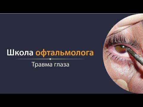Видео: Школа офтальмолога. Травма глаза