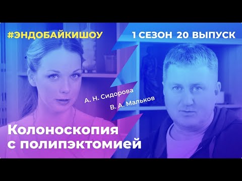 Видео: #ЭНДОБАЙКИШОУ. СЕЗОН 1, ВЫПУСК 20. КОЛОНОСКОПИЯ С ПОЛИПЭКТОМИЕЙ
