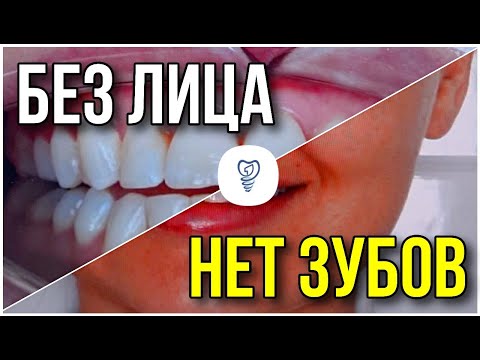 Видео: Без лица нет зубов и без зубов нет лица. #dentist