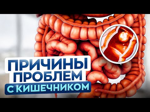 Видео: Болезни кишечника и кто в этом виноват – вы, глисты или грибки?