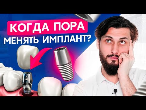 Видео: Что будет с зубными имплантами через 10 лет? Срок службы зубных имплантов
