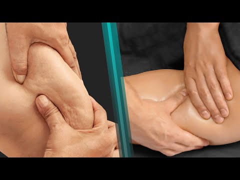Видео: Этапы проведения антицеллюлитного массажа, промежутки между сеансами, способы «сжигания» жира
