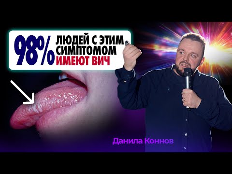 Видео: Самые ЯВНЫЕ симптомы ВИЧ