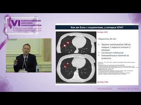 Видео: Тимофеев Илья Валерьевич - Как изменилась жизнь больных раком почки за последние 10 лет