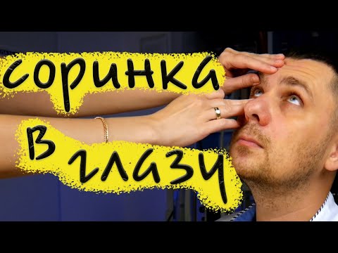 Видео: Соринка в глазу | Инородное тело в глазу
