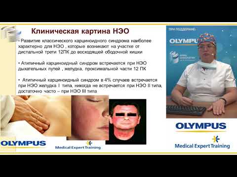 Видео: Нейроэндокринные опухоли желудочно-кишечного тракта. Малихова О. А.