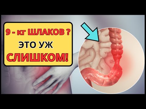Видео: ОЧИЩЕНИЕ КИШЕЧНИКА И ПЕЧЕНИ 💥 Я В ШОКЕ Вышло 9 кг шлаков! ПРАВДА ИЛИ МИФ?