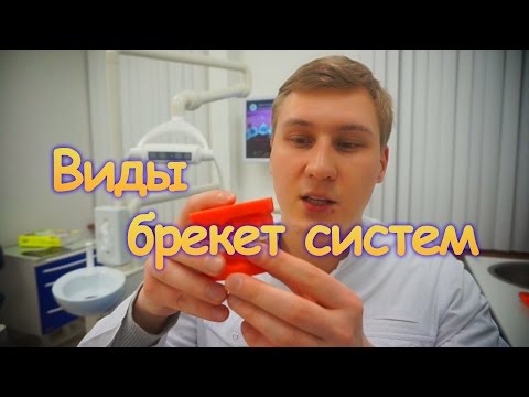Видео: Виды брекет систем