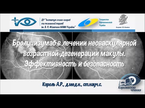 Видео: Визкью (brolucizumab) - новое поколение анти-VEGF препаратов. Эффективность и безопасность.