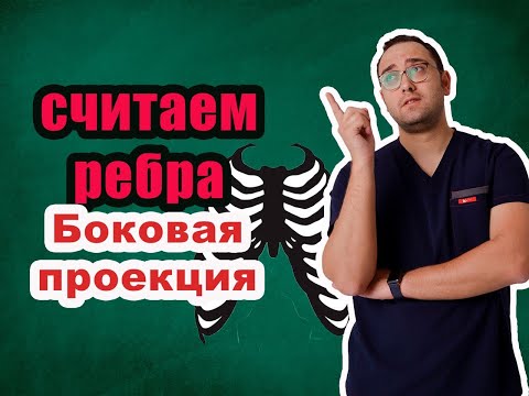 Видео: Как считать ребра на рентгенограмме? БОКОВАЯ ПРОЕКЦИЯ | Рентгенология